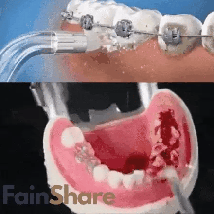 Irrigador Bucal Limpieza Profunda ┃CleanSmile™