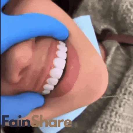 Irrigador Bucal Limpieza Profunda ┃CleanSmile™