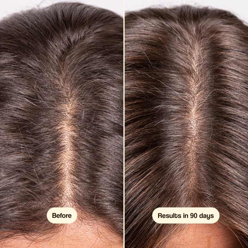 Hair Growth 120 cápsulas – Fortalece tu Belleza desde Adentro