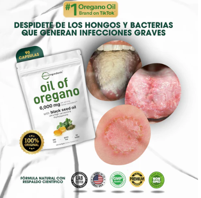 Oil of Oregano en cápsulas