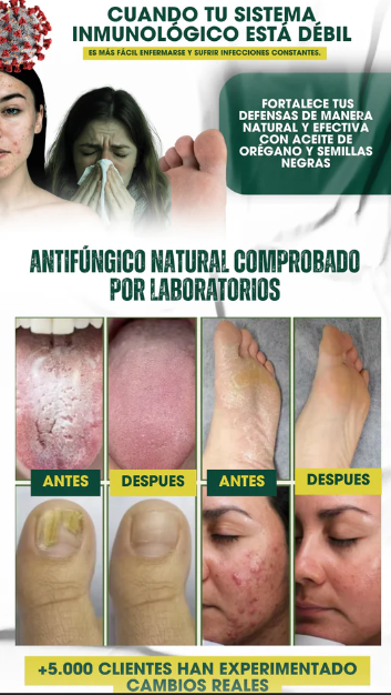 Oil of Oregano en cápsulas