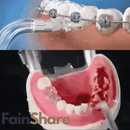 Irrigador Bucal Limpieza Profunda ┃CleanSmile™