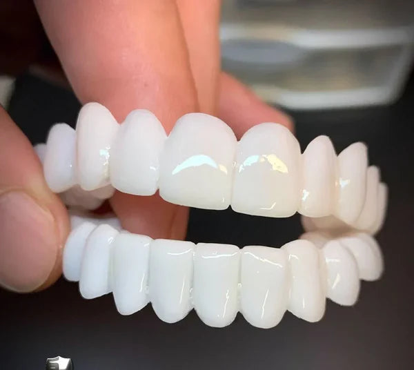 Carillas Dentales Snap On Smile