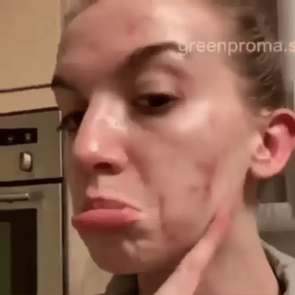 Spray Para Cicatrices